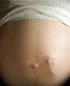 Imagen de barriga embarazada